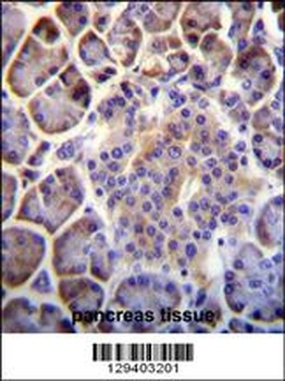 PTCHD4 Antibody