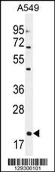 EDN1 Antibody