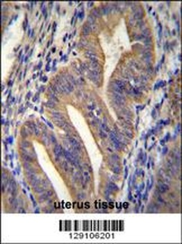 METTL10 Antibody