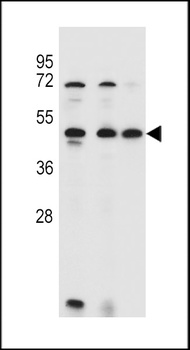 ANKRD40 Antibody