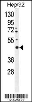 LRTM2 Antibody