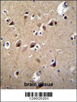 LRTM2 Antibody