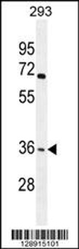 OR4F15 Antibody