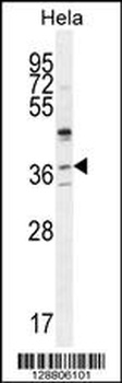 SELV Antibody