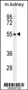 FBXO47 Antibody