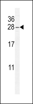 ARL5B Antibody