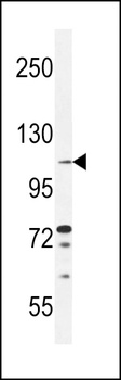 TLL2 Antibody