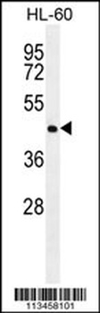 NR6A1 Antibody