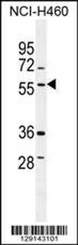 TSNARE1 Antibody