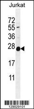 POLR2J Antibody