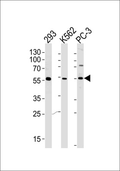 PIP5KL1 Antibody