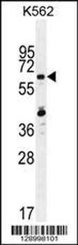 ZNF619 Antibody