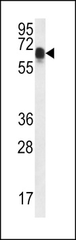 CCDC102A Antibody