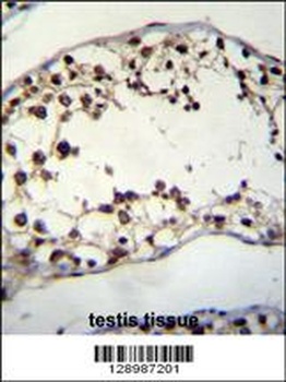 PIH1D2 Antibody