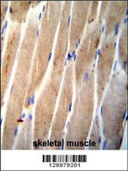 CLEC4F Antibody