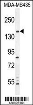 CAMSAP1 Antibody