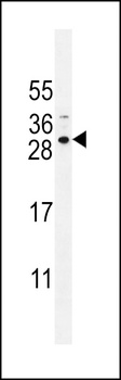 SPACA5B Antibody