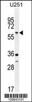 TNFRSF1A Antibody