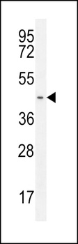 GPR142 Antibody