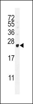 GAGE12B Antibody
