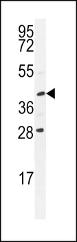 USP50 Antibody