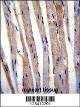 KRT73 Antibody