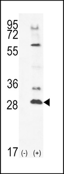 TSSK4 Antibody