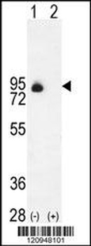 ENG Antibody
