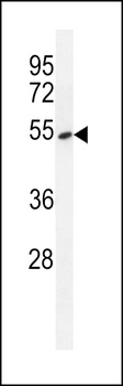 TDP2 Antibody