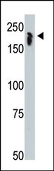 NCOR1 Antibody