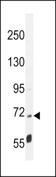 PPP1R37 Antibody
