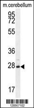 VSTM2A Antibody