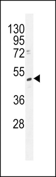 TRMT2B Antibody