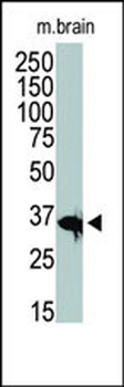 HDAC11 Antibody