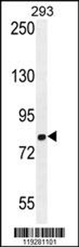 GGCX Antibody