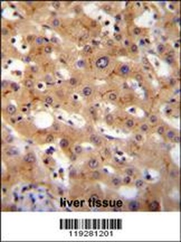 GGCX Antibody