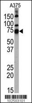 HDAC10 Antibody