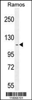 HIP1R Antibody