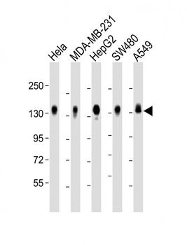 IL6ST Antibody