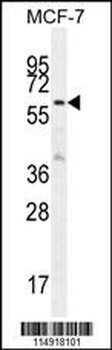 KARS Antibody