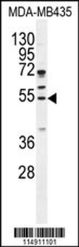 CCNB1 Antibody