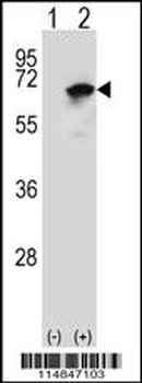 NARS Antibody