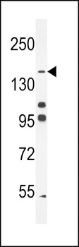 PTPRJ Antibody