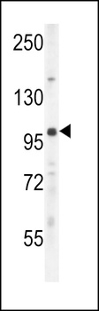 UNK Antibody