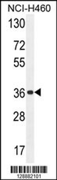 OR4A47 Antibody