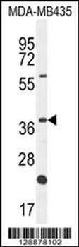 OR6V1 Antibody