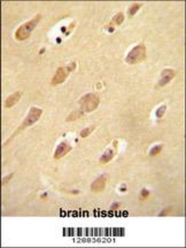 OR5L2 Antibody