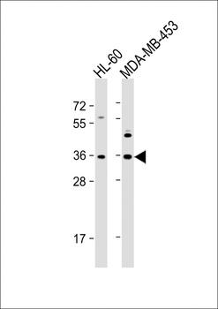 OR1J4 Antibody