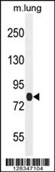 TTC30B Antibody