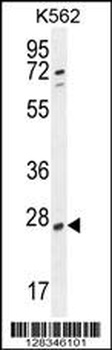 hCG_2024410 Antibody